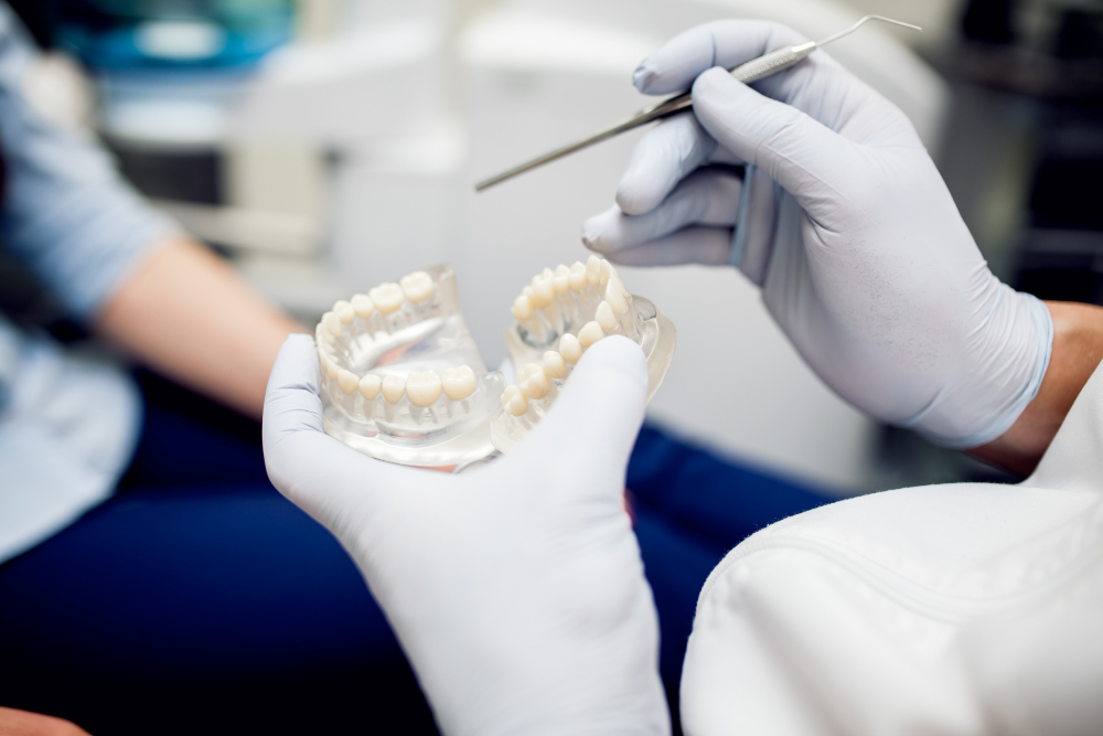 Tipuri de coroane dentare și cum să alegi cea mai bună opțiune