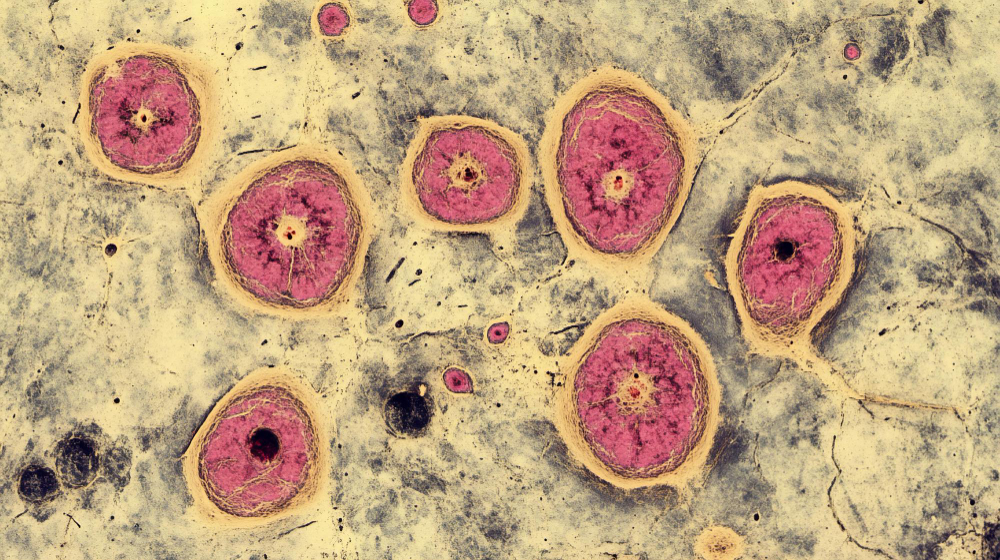 Entamoeba histolytica
